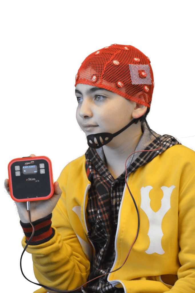 tdcs, cihazı , tes , transkranial elektrikal stimilasyon